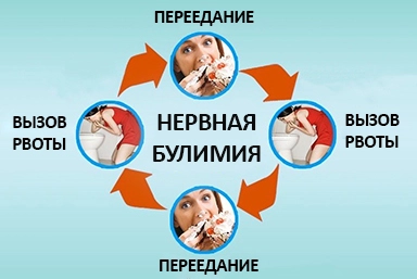 Лечение булимии в Верх-Усуглях